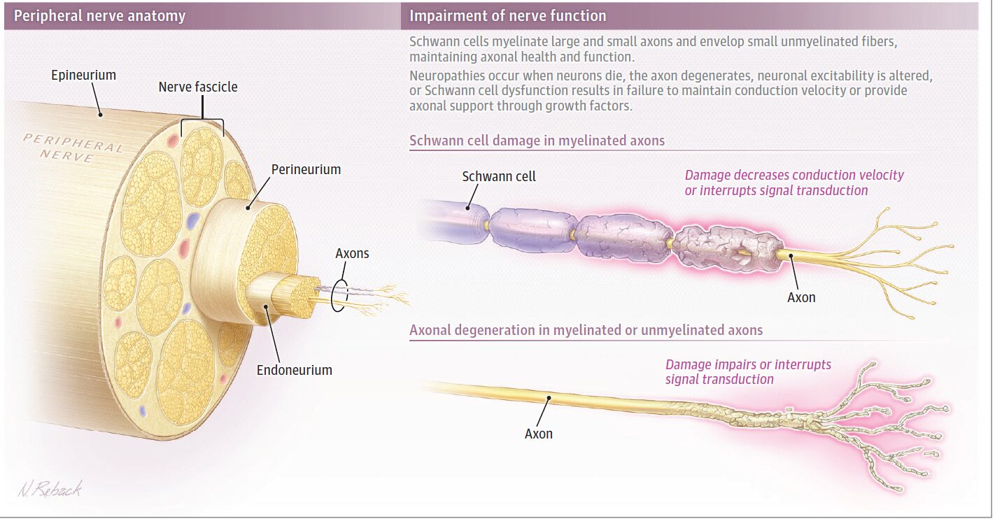 薬剤師のための末梢神経障害（PN）治療の最前線レビュー